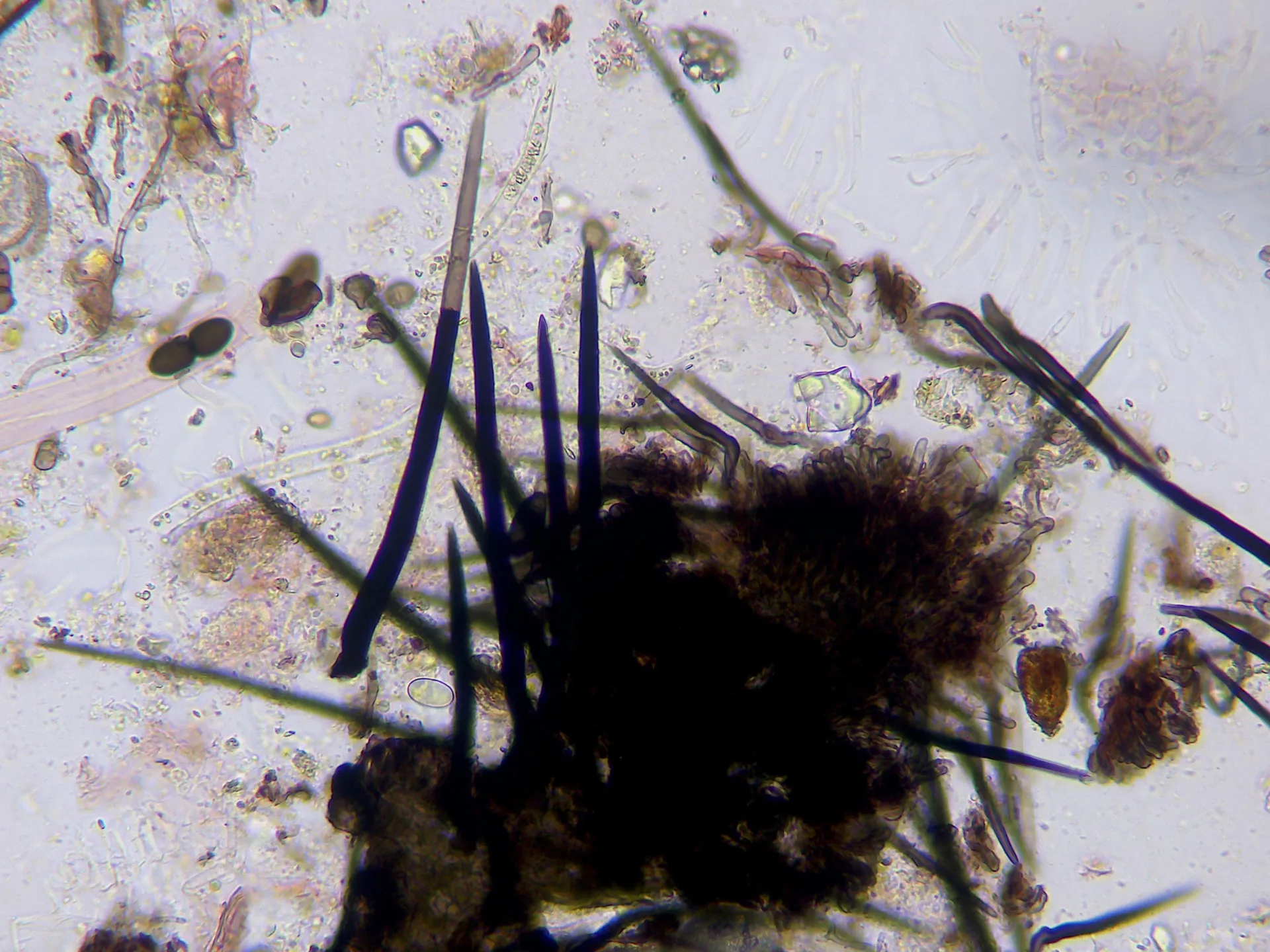 Microscopía de Trichodelitschia bisporula - 10 - Pelos x 400-002
